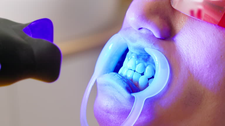 Prudentoe Teeth Whitening home visit in Hyderabad